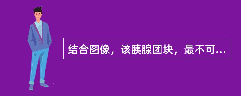 结合图像，该胰腺团块，最不可能的诊断为（）