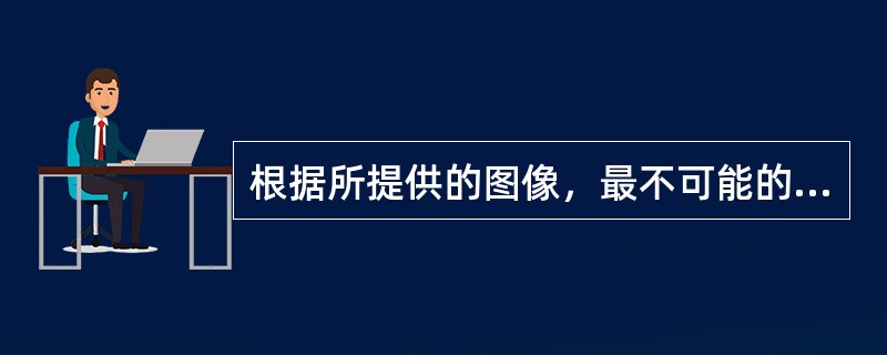 根据所提供的图像，最不可能的诊断是（）