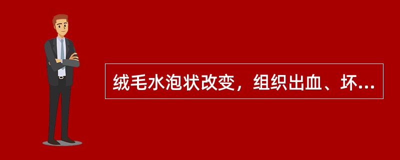 绒毛水泡状改变，组织出血、坏死，侵入子宫肌层()坏死灶内见滋养细胞、血块及凝固性