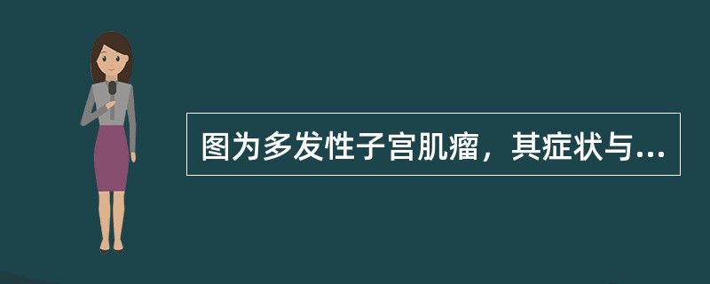 图为多发性子宫肌瘤，其症状与下述何项关系密切()