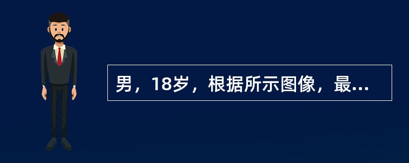 男，18岁，根据所示图像，最可能的诊断是（）
