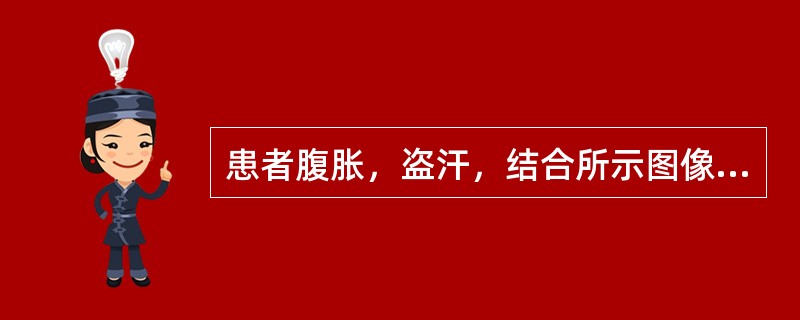 患者腹胀，盗汗，结合所示图像，最可能的诊断是（）