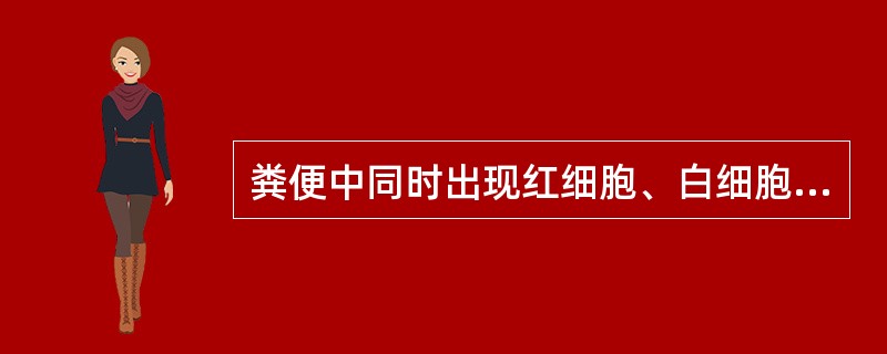 粪便中同时出现红细胞、白细胞、巨噬细胞最可能的疾病是A、结肠癌B、急性细菌性痢疾