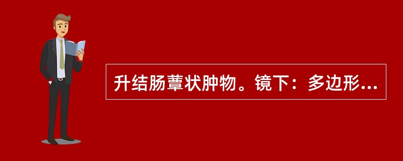 升结肠蕈状肿物。镜下：多边形及柱状上皮细胞呈巢状及宽索状排列或形成片块，细胞异型