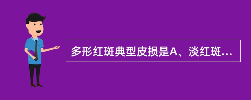 多形红斑典型皮损是A、淡红斑鳞屑B、水疱或大疱C、黏膜糜烂D、有靶形或虹膜样皮疹