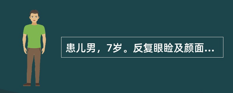 患儿男，7岁。反复眼睑及颜面水肿5个月，尿量减少及肉眼血尿不明显。尿常规：尿蛋白