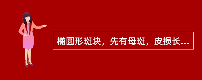 椭圆形斑块，先有母斑，皮损长轴与皮纹走向一致。诊断( )。