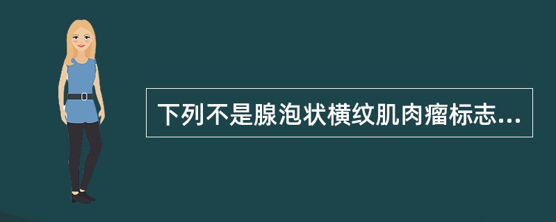 下列不是腺泡状横纹肌肉瘤标志物的是A、desminB、MyogininC、Myo