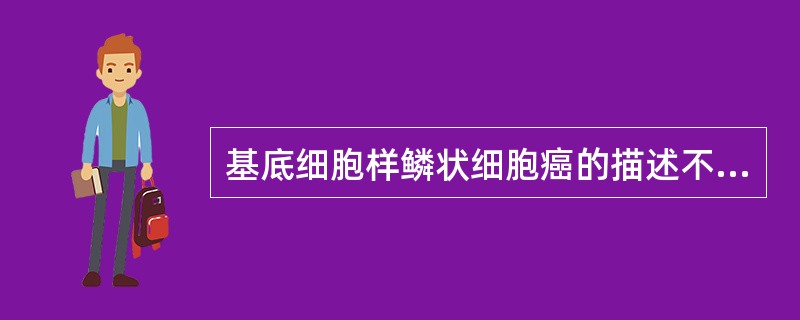 基底细胞样鳞状细胞癌的描述不正确的是（）A、多发生在喉、咽下和舌根部B、以60