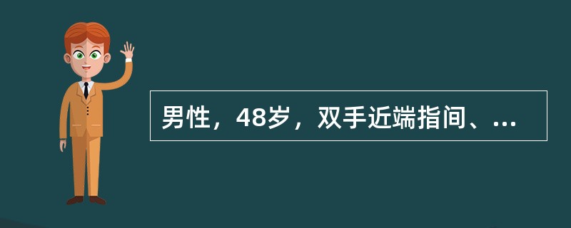 男性，48岁，双手近端指间、腕关节肿痛6个月，伴晨僵>2h／d，ESR80mm（