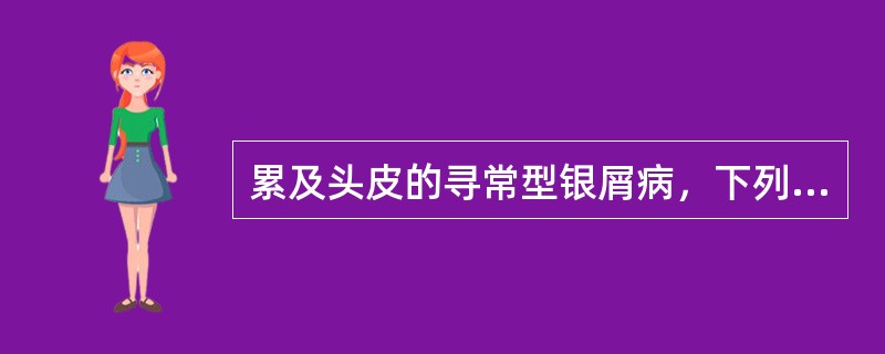 累及头皮的寻常型银屑病，下列特征不正确的是（）。