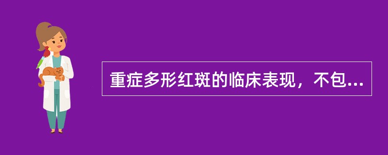 重症多形红斑的临床表现，不包括（）。