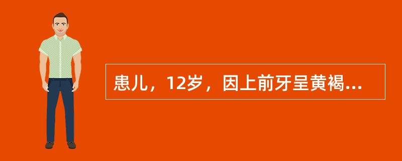 患儿，12岁，因上前牙呈黄褐色就诊。检查：上前牙呈黄褐色，釉质点状缺损。6岁前生