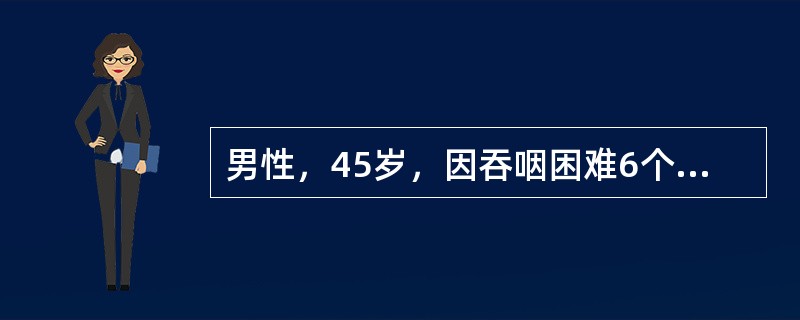 男性，45岁，因吞咽困难6个月来院就诊。体格检查未发现阳性体征。此时，首先考虑的