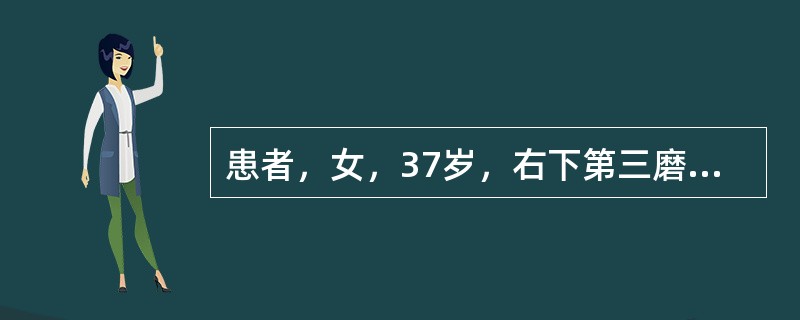 患者，女，37岁，右下第三磨牙缺失，第二磨牙Ⅲ度根分叉病变，远中根垂直吸收近根尖