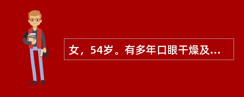 女，54岁。有多年口眼干燥及多发性肌炎病史，否认头颈部放疗史；体检示：玫瑰红染色