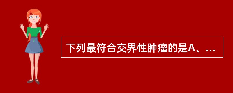 下列最符合交界性肿瘤的是A、发生于表皮与真皮交界处的肿瘤B、癌前病变C、介于良性