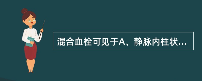 混合血栓可见于A、静脉内柱状血栓的尾部B、毛细血管内C、急性风湿性心内膜炎的瓣膜