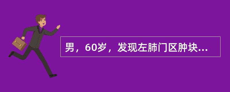 男，60岁，发现左肺门区肿块5个月，近1个月来出现声嘶、吞咽困难，痰液细胞学检查