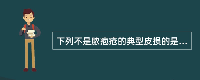 下列不是脓疱疮的典型皮损的是A、脓疱B、风团C、蜜黄色结痂D、水疱E、糜烂 -