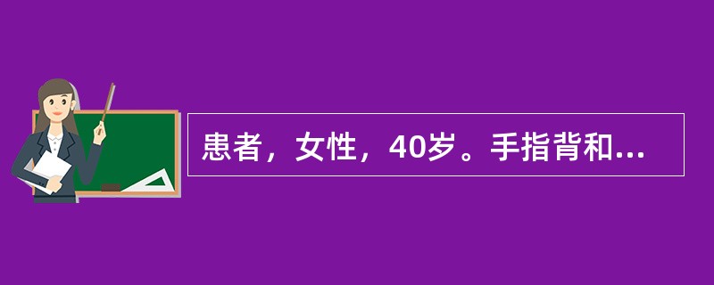 患者，女性，40岁。手指背和掌面出现境界不清的皮损，角化明显，有浸润增厚，伴有皲