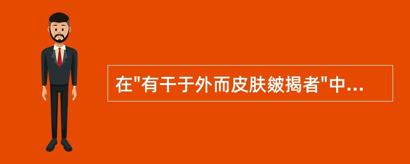 在"有干于外而皮肤皴揭者"中，"皴揭"之义为( )A、皮肤皲裂B、皮肤燥裂C、揭