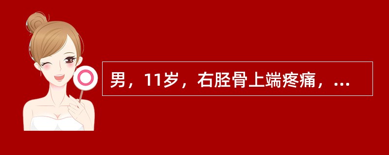 男，11岁，右胫骨上端疼痛，肿胀，压痛，关节活动受限。X线片示右胫骨上端偏右骨密