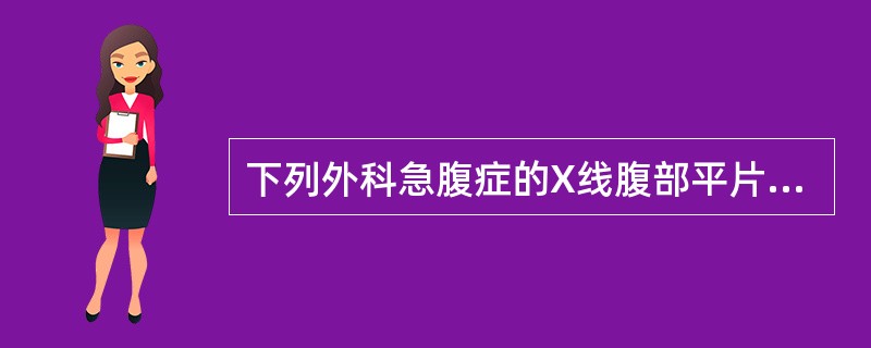 下列外科急腹症的X线腹部平片影像特征中，错误的是A、肠管内"气液平"B、膈下游离
