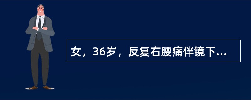 女，36岁，反复右腰痛伴镜下血尿2年。KUB示右肾下极多发结石，右输尿管下段结石