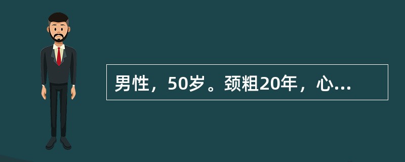 男性，50岁。颈粗20年，心悸、乏力1年，加重1个月。查体：尤突眼，甲状腺Ⅱ度肿