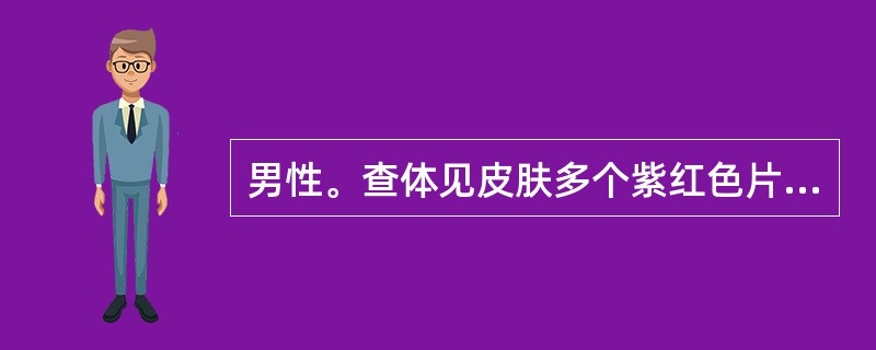 男性。查体见皮肤多个紫红色片状改变，压之不褪色，直径4mm。应诊断为A、紫癜B、