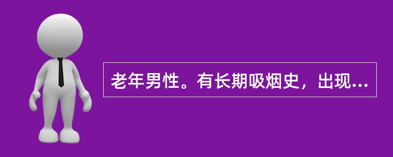 老年男性。有长期吸烟史，出现刺激性咳嗽，痰中带血，最可能为A、支气管扩张B、支气