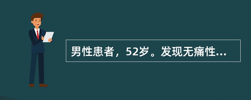 男性患者，52岁。发现无痛性血尿1个月，首先应考虑A、肾结石B、膀胱结石C、膀胱