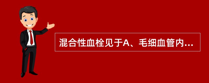 混合性血栓见于A、毛细血管内B、静脉血栓的尾部C、延续性血栓的体部D、动脉血栓的