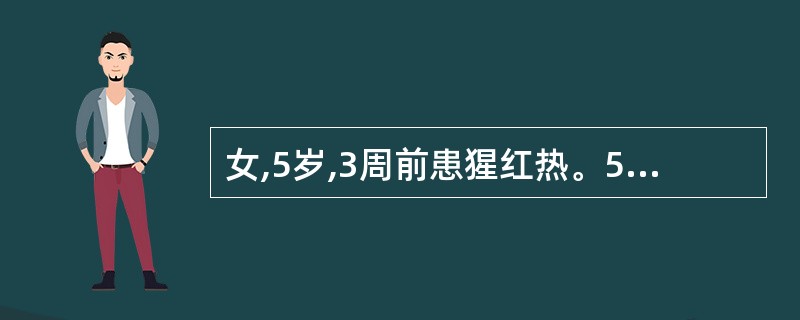 女,5岁,3周前患猩红热。5天前眼睑水肿,尿色深黄,诊断为急性链球菌感染后肾小球