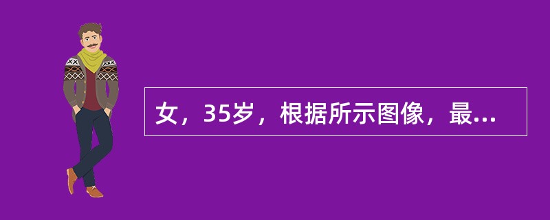 女，35岁，根据所示图像，最可能的诊断是（）