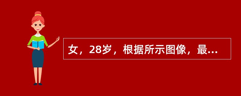 女，28岁，根据所示图像，最可能的诊断是（）