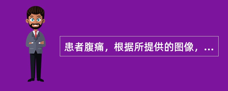 患者腹痛，根据所提供的图像，最可能的诊断是（）