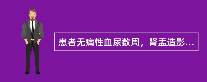 患者无痛性血尿数周，肾盂造影示肾盂内不规则充盈缺损，首先考虑以下哪种疾病()