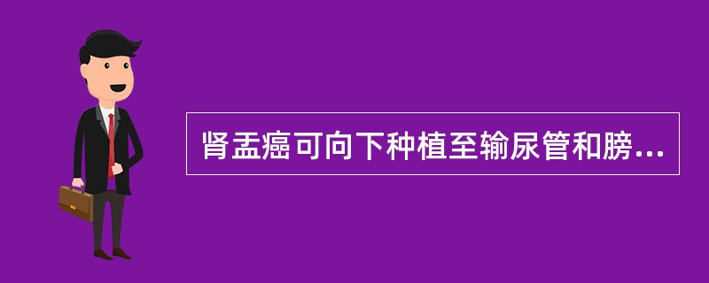 肾盂癌可向下种植至输尿管和膀胱。