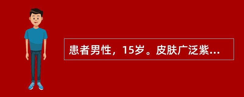 患者男性，15岁。皮肤广泛紫癜伴大量鼻出血1周，病前2周有上呼吸道感染史。肝、脾