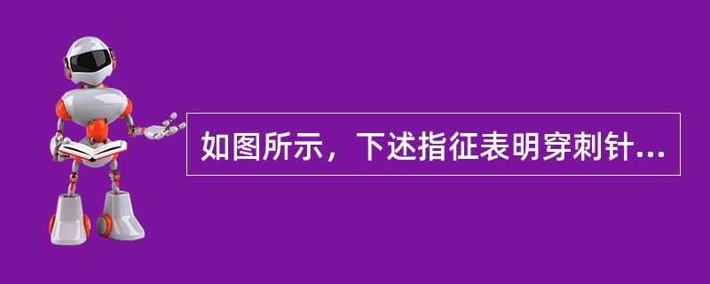 如图所示，下述指征表明穿刺针进入硬膜外间隙，除外（）。
