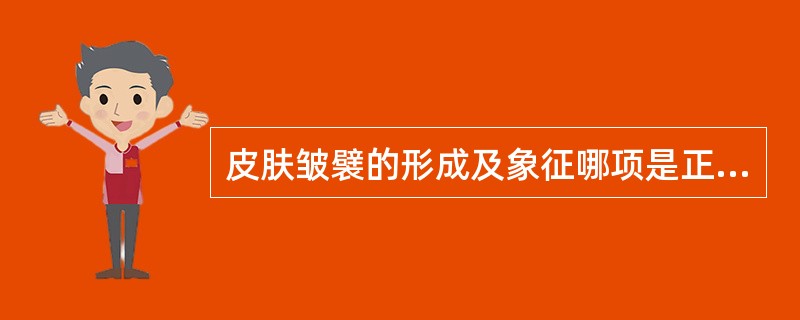 皮肤皱襞的形成及象征哪项是正确的（）。