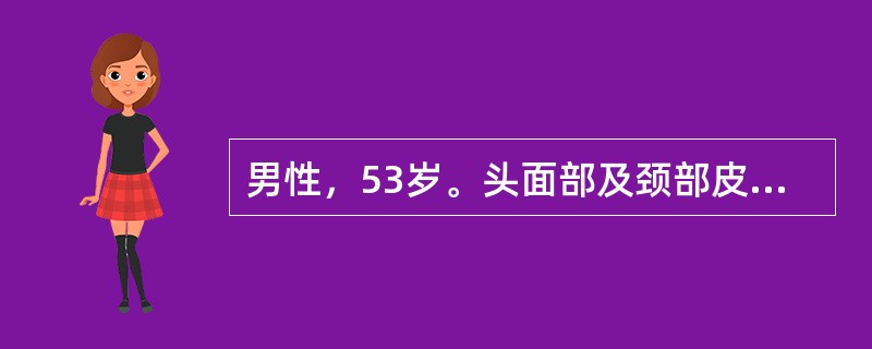 男性，53岁。头面部及颈部皮疹1年余，四肢乏力3个月。查体：眶周可见紫红色水肿斑