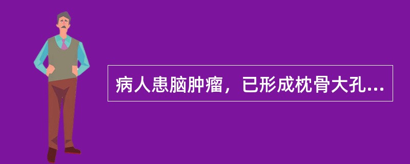 病人患脑肿瘤，已形成枕骨大孔疝，可能是什么肿瘤（）