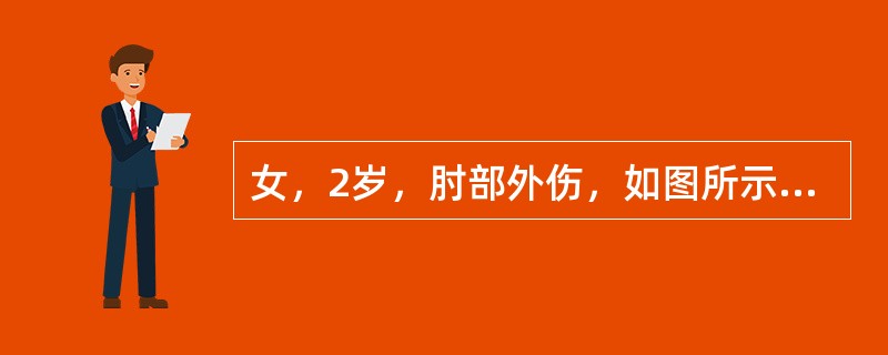 女，2岁，肘部外伤，如图所示，最佳的诊断为（）.