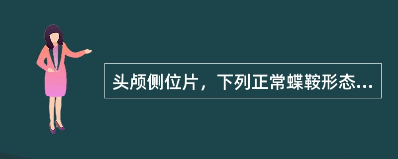 头颅侧位片，下列正常蝶鞍形态中，正确的是（）.