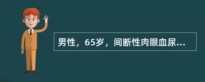 男性，65岁，间断性肉眼血尿3月余，血尿时尿中偶有血块，期间曾有两次左肾区绞痛史