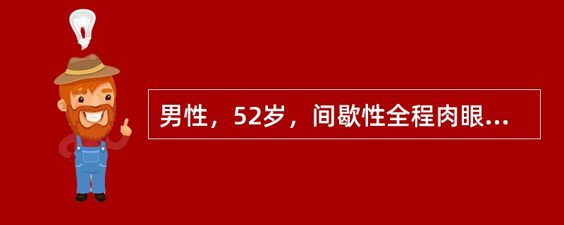 男性，52岁，间歇性全程肉眼血尿1年余。血尿伴有不规则小血块及轻度膀胱刺激症状，