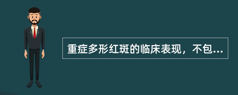 重症多形红斑的临床表现，不包括（）